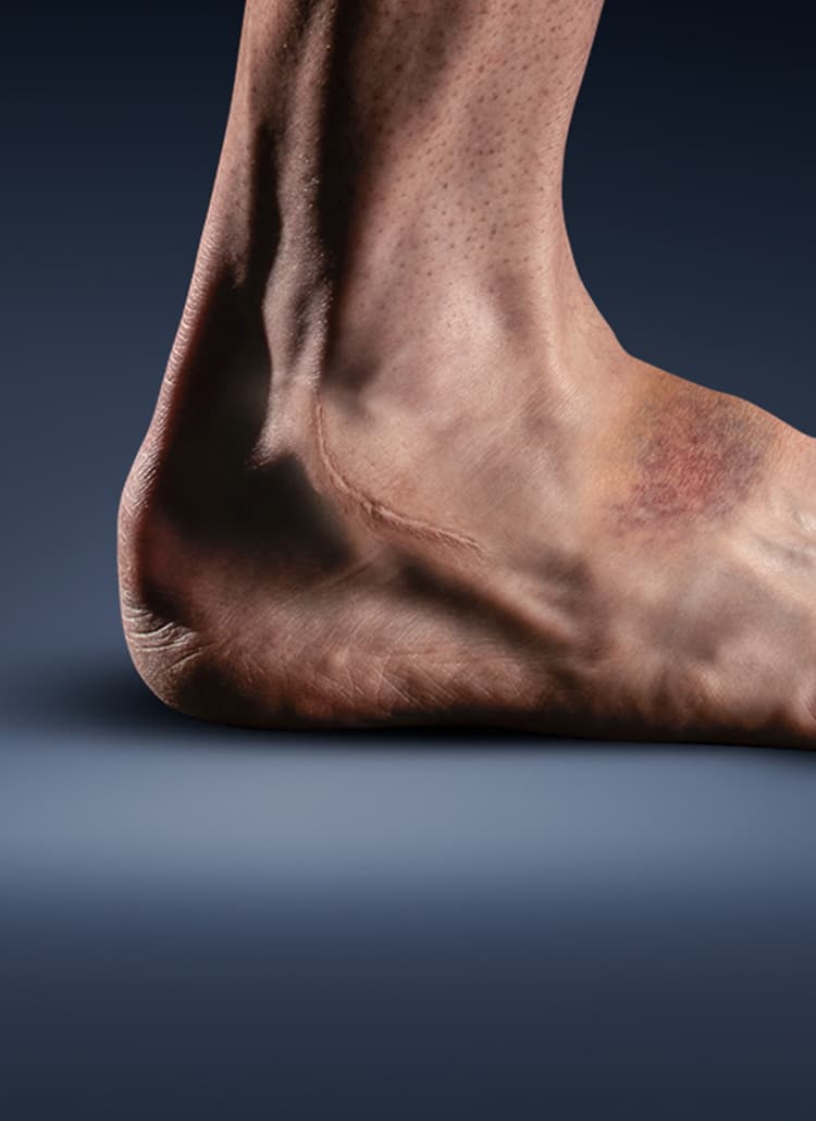 foot_750x1030
